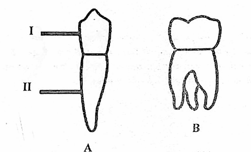 Diagram for question 43