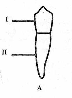 Diagram for question 42