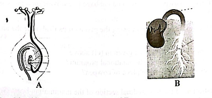 Diagram for question 64