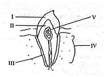 Diagram for question 42