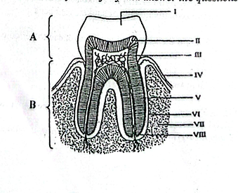 Diagram for question 55