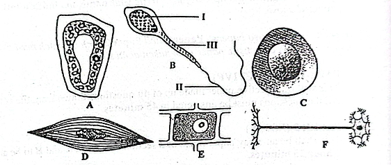 Diagram for question 41